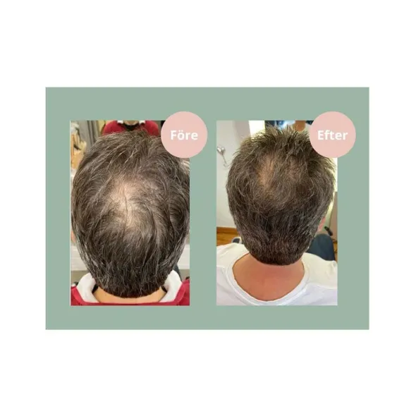 Hair Growth Balsam 250ml