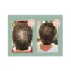Hair Growth Schampo 250ml