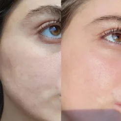 Serum of Clear 30ml