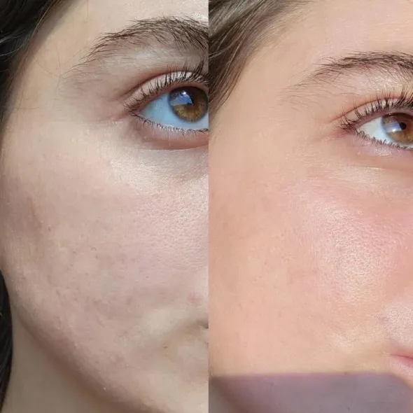 Serum of Clear 30ml